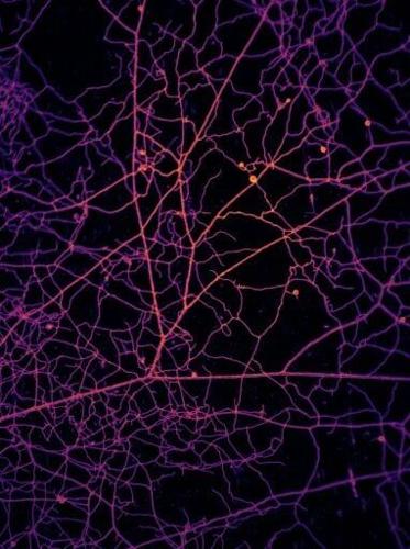 A microscopic image of network formed by arbuscular mycorrhizal fungi
