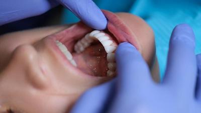 Oral Health Linked To Migraines, Fibromyalgia