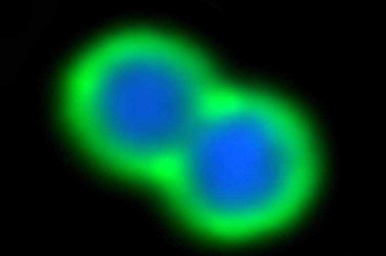 Drug resistant superbugs could be beaten by treating diseases with human antibodies