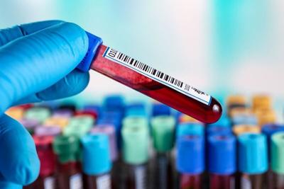 FDA Gives Marketing Nod to Blood Test for Diagnosing Alzheimer Disease