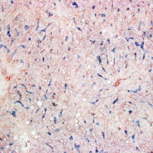 Pigeons navigate by using magnetic sensors in their livers, suggests study