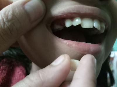 Child oral health