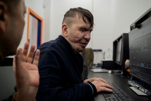 Blinded Ukrainian soldiers face new challenges at home