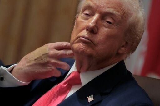 US President Donald Trump says he does not fall asleep in public despite instances where he appears to be struggling to keep his eyes open