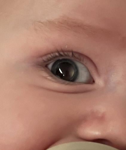 Mum thought baby’s “wonky” eye was adjusting but it was rare cancer
