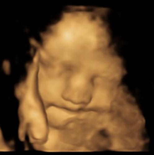 Toddlers can remember vegetable smells from the womb, reveals study