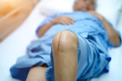 Spouses Also Benefit From Partner's Knee/Hip Replacement