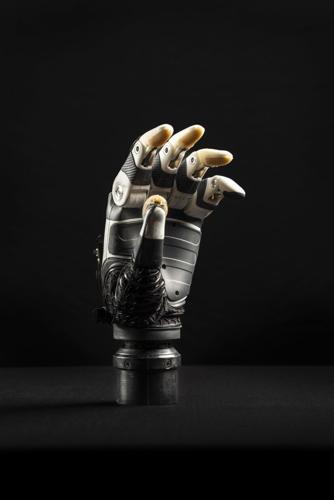 Bionic hand given AI “mind of its own” to make life easier for amputees
