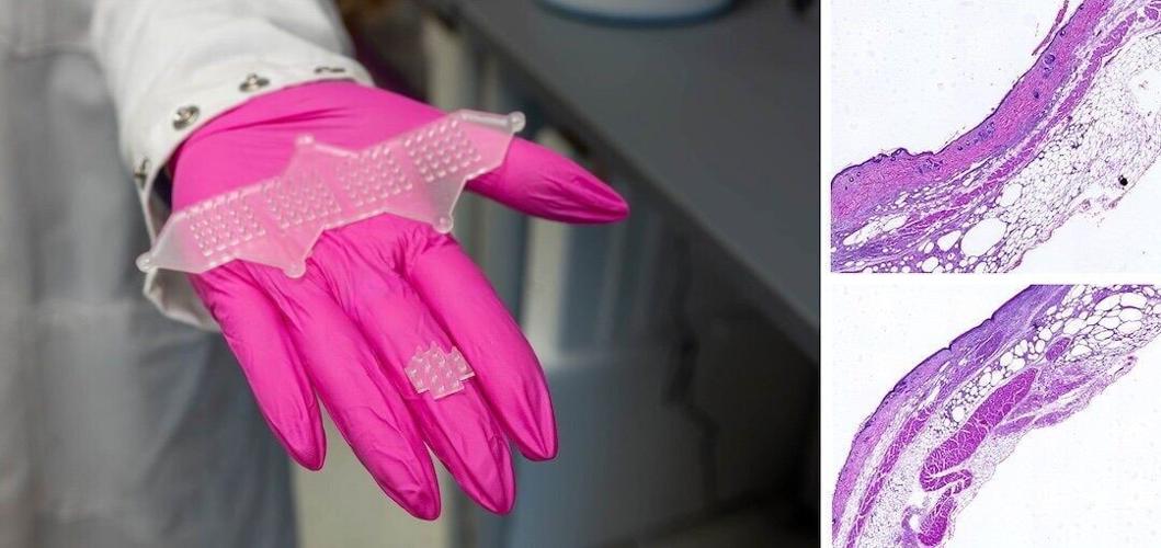 New “living bandage” accelerates healing of wounds
