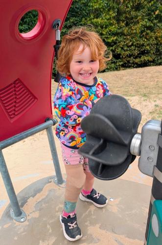 Girl born disabled after mom contracts chickenpox during pregnancy