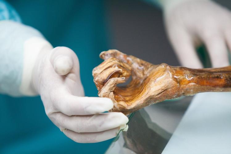 Microbial contents of 5,300-year-old Ötzi the Iceman’s body revealed