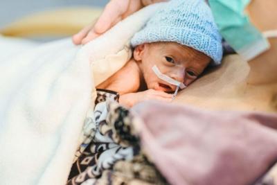 What Your Preemie Is Fed Today Impacts Tomorrow's Milestones