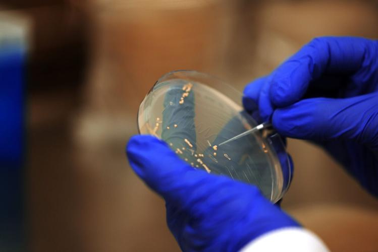 Universal flu vaccine derived from yeast could replace annual jabs, suggests study