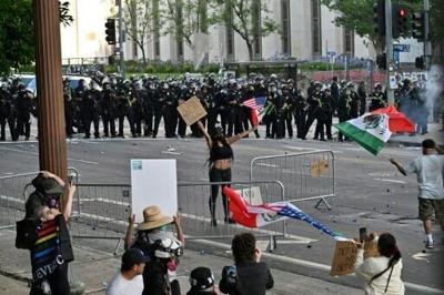 AFP photographer shot in face with rubber bullet at LA protest
