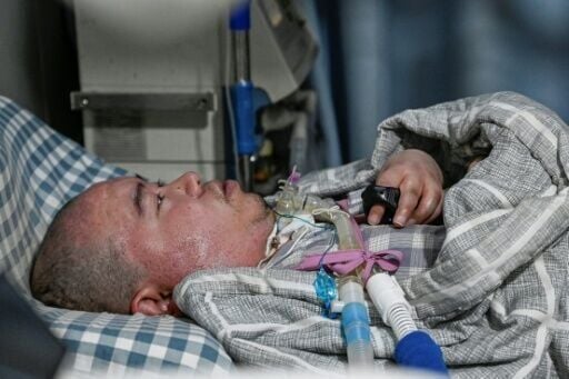 Li Xia has Duchenne muscular dystrophy, an incurable genetic disease, and relies on a ventilator permanently connected to his windpipe to breathe