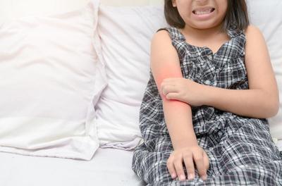 COVID Vaccine Offers Health Boost For Kids With Eczema
