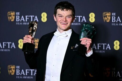 British actor Robert Aramayo won Best Actor and Rising Star for his performance in 'I Swear'