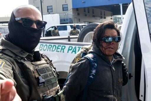 A person bleeds from the face after being detained during an immigration crackdown by federal agents in New Orleans