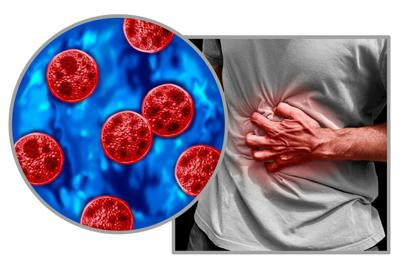 Cyclosporiasis can cause severe gastrointestinal distress, including explosive diarrhea.