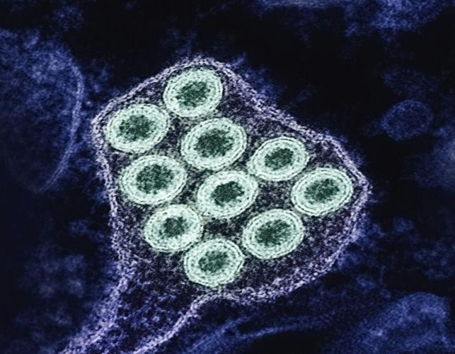 national-institute-of-allergy-and-infectious-diseases-9kqpqAWha64-unsplash