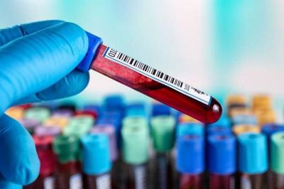 Blood Test Can Help Diagnose, Track ALS