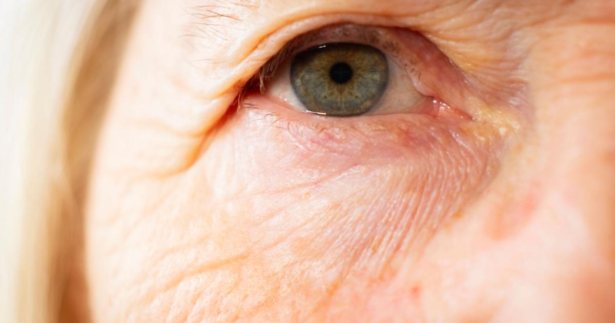 Seasonal allergies in southwest Montana: What’s causing your symptoms and when to seek help