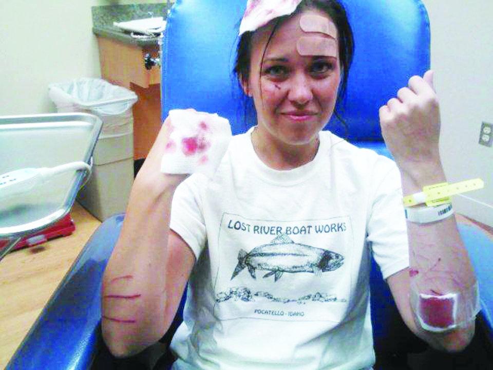 Woman begins recovery process following otter attack | Wildlife ...