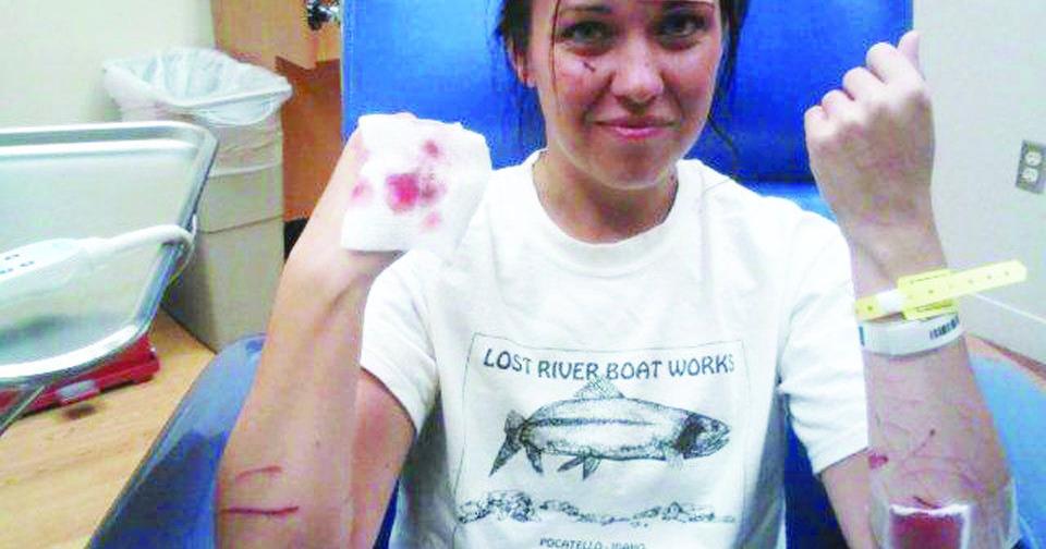 Woman begins recovery process following otter attack | Wildlife ...