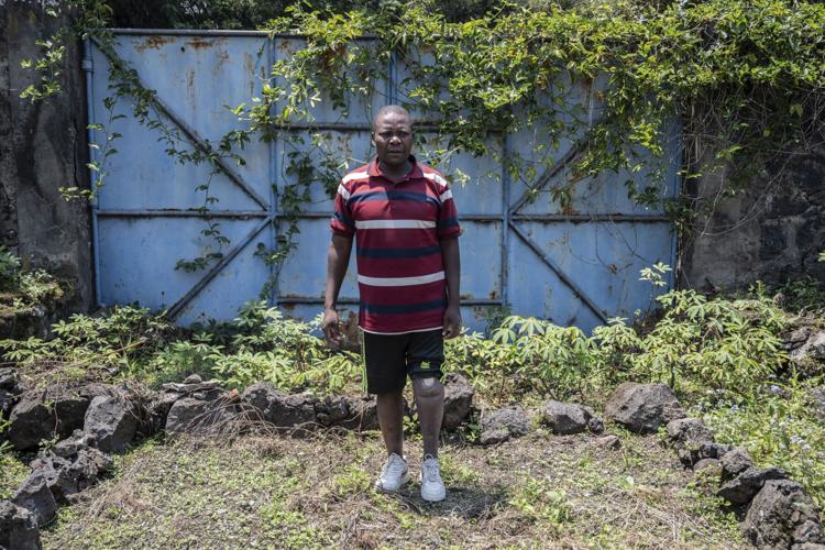 Photos of an orthopedic center in Congo that helps amputees regain