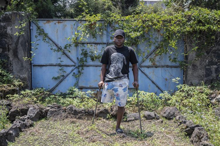 Photos of an orthopedic center in Congo that helps amputees regain
