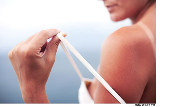 Top 6 most embarrassing (yet common) tan lines