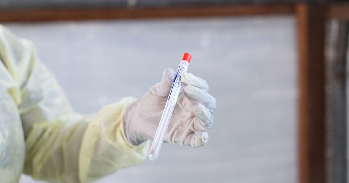 Dutch Scientist Charged With Conspiring to Smuggle Mpox Virus Into U.S. Ephrat Livni Jun 9, 2026 1 hr ago