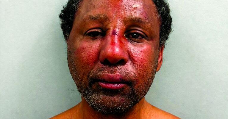 GOOD SAMARITAN SLASHED IN PARK: Man arrested after using box cutter on ...