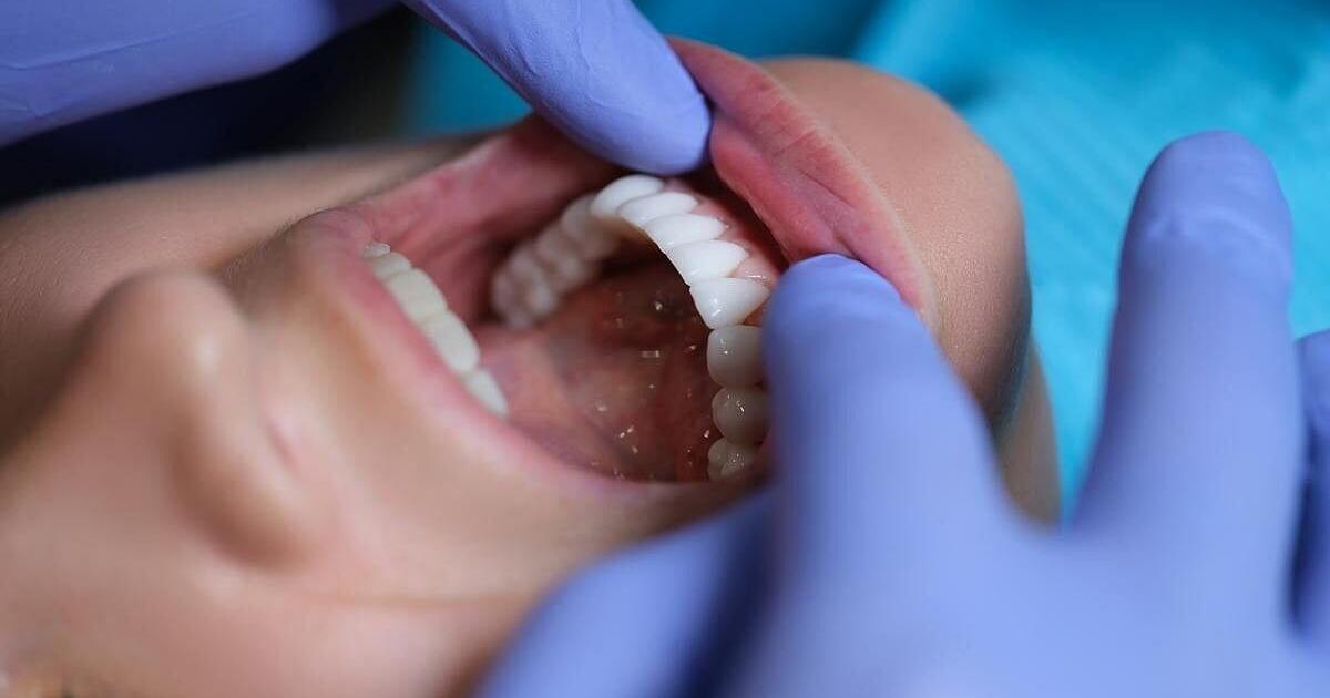 Oral Health Linked To Migraines, Fibromyalgia | Health