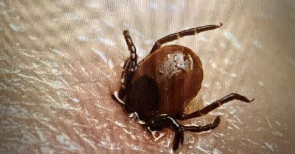 It's that time again: Tick, tick, boom! Don't let Lyme disease blow up your summer