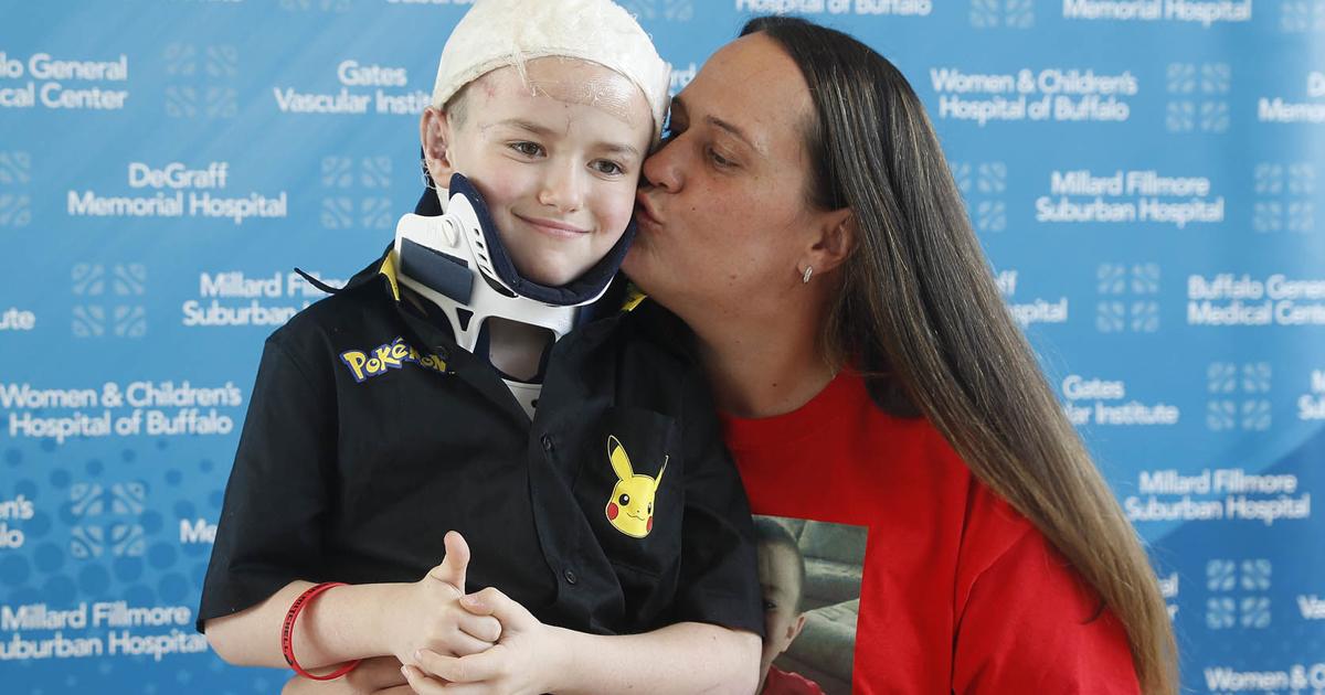 'This is what we do': Doctor who saved 7-year-old dog bite victim's life