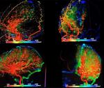 Sydney Johnson brain scans