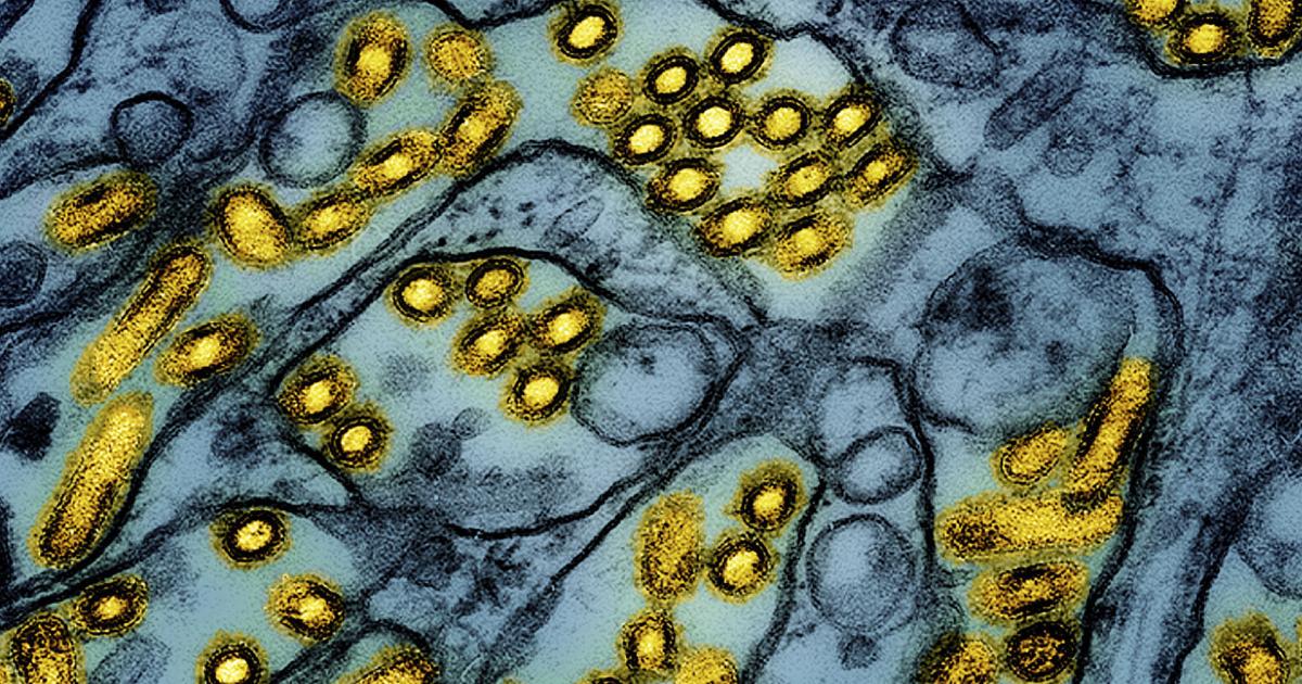 First U.S. Bird Flu Death Reported in Louisiana