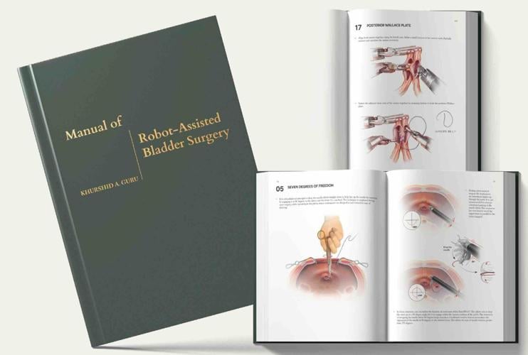 Surgical Manual from Roswell Park Created to Advance Bladder Cancer Surgery Worldwide