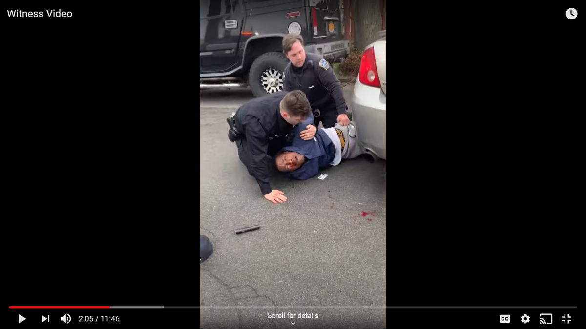 Suttles suffers injuries screenshot