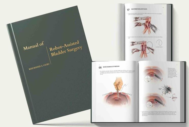 Surgical Manual from Roswell Park Created to Advance Bladder Cancer Surgery Worldwide