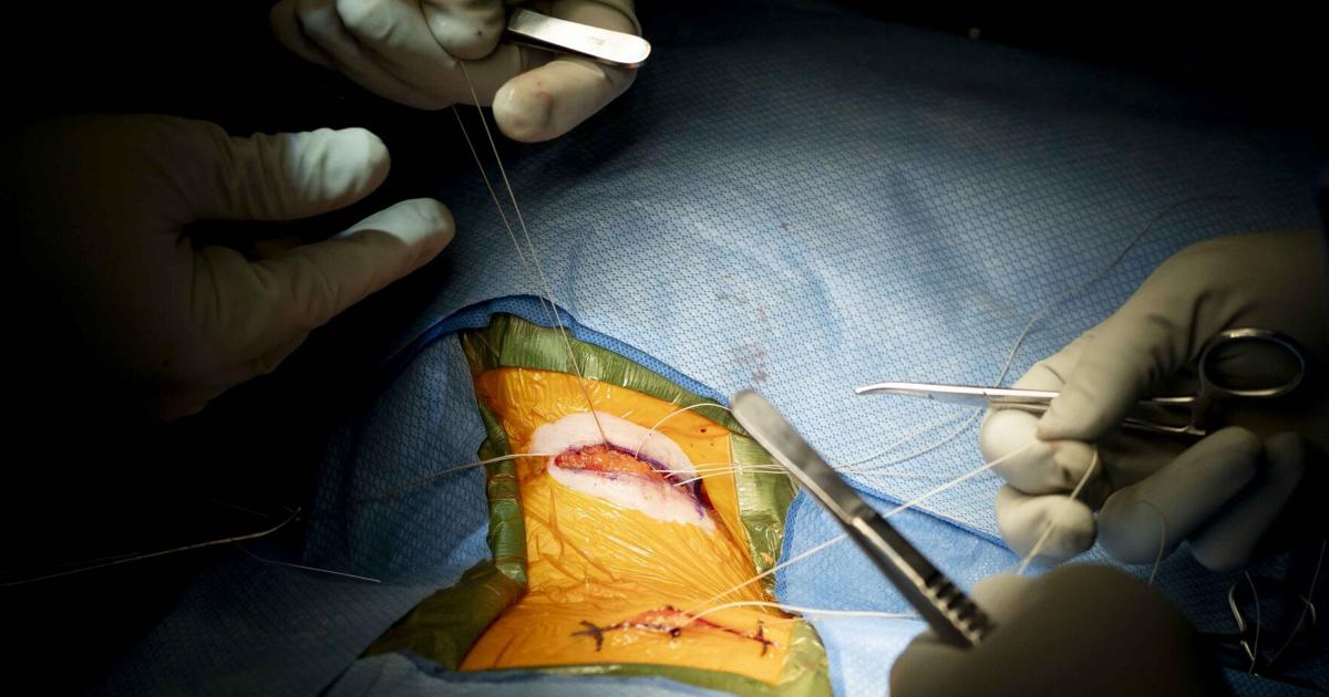 Superpath Small Incision Two small incisions