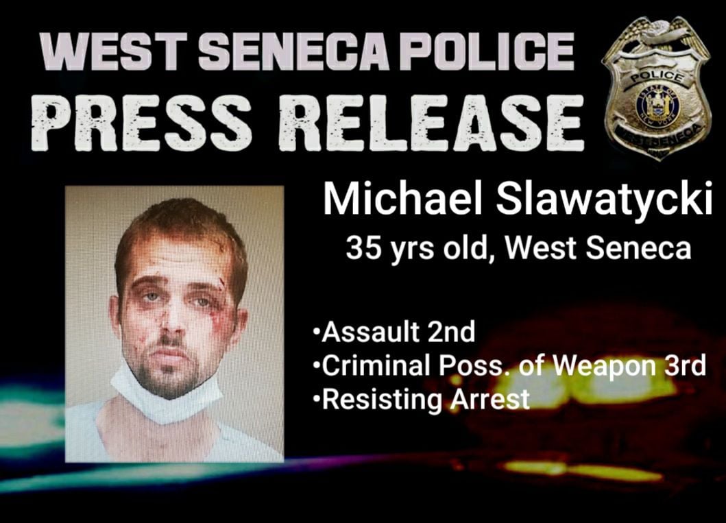 West Seneca man arrested for assault girlfriend hospitalized with stab