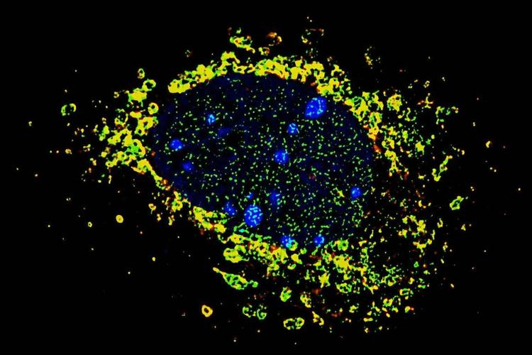 Roswell Park Experts Discover Metabolic Pathway in Cell Nucleus That Helps Cancer Progress