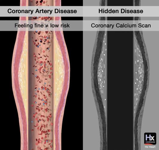 Medmovie's Hx Heart Video Library Powers Patient Education at Cardiovascular Practices Worldwide