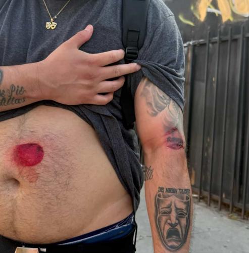 Andrew Guerrero less lethals