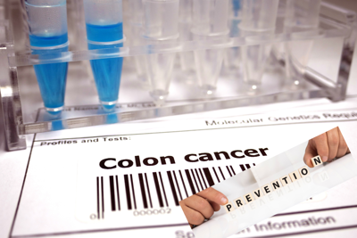 colorectal cancer prevention - 1