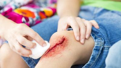 Pass on the peroxide: A surgeon’s guide to cleaning wounds at home