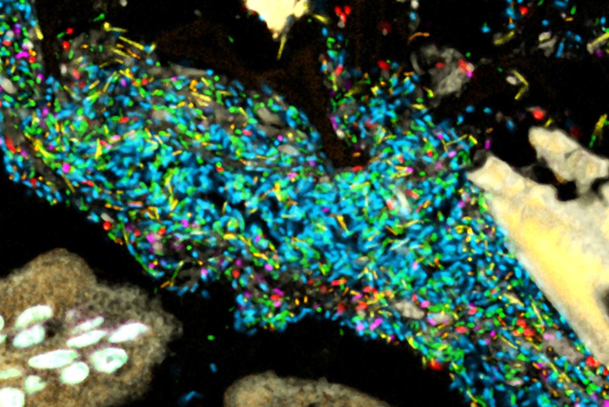 Mbl Scientist Takes A Closer Look At The Human Microbiome