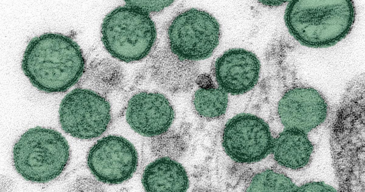 Hantavirus: What Madison experts want you to know